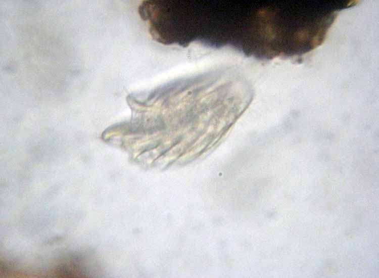 Protozoi del muschio: Phacodinium metchnicoffi ?